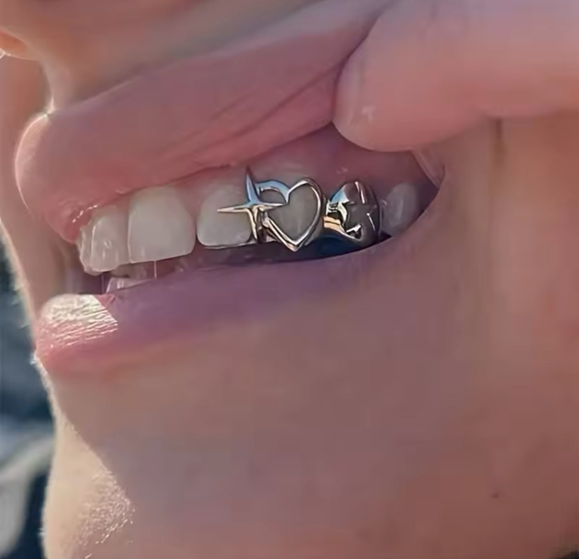 Star Glitch Tooth Socket